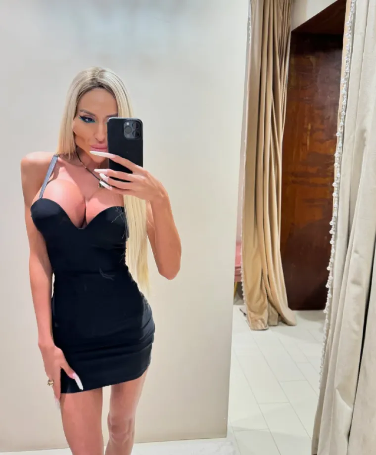 Žena s najvećim obrazima u dugotrajnom je procesu otapanja filera: Promjene su već vidljive