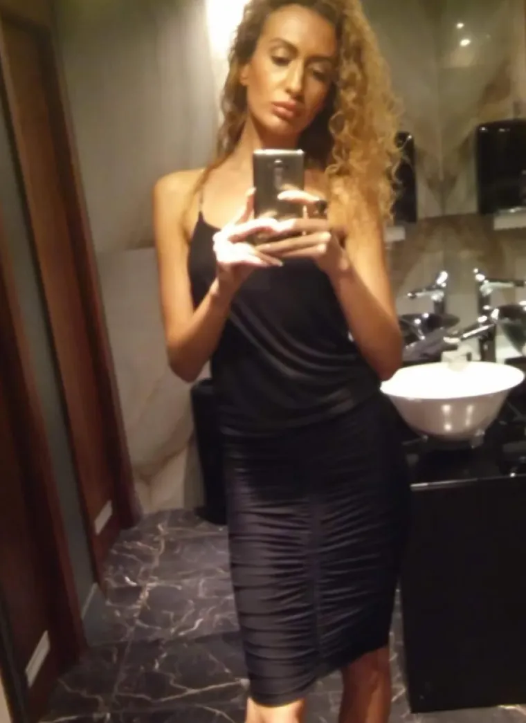 Žena s najvećim obrazima u dugotrajnom je procesu otapanja filera: Promjene su već vidljive