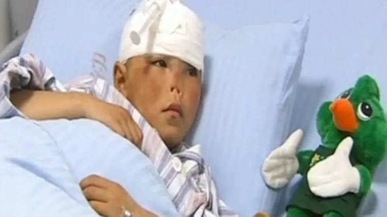 Djevojčica kojoj je štakor odgrizao nos dobiva novi