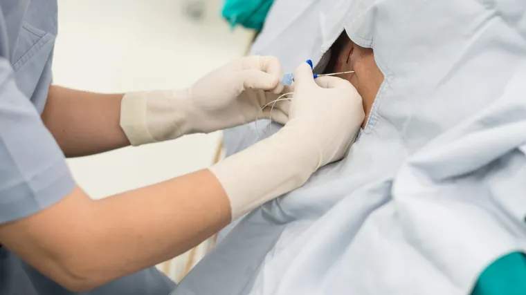 Epiduralna analgezija: evo koje su prednosti i mane ove metode na porođaju