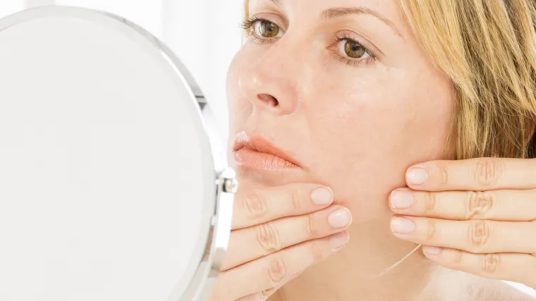 Hormonalne akne: zašto do njih dolazi i kako ih se riješiti?