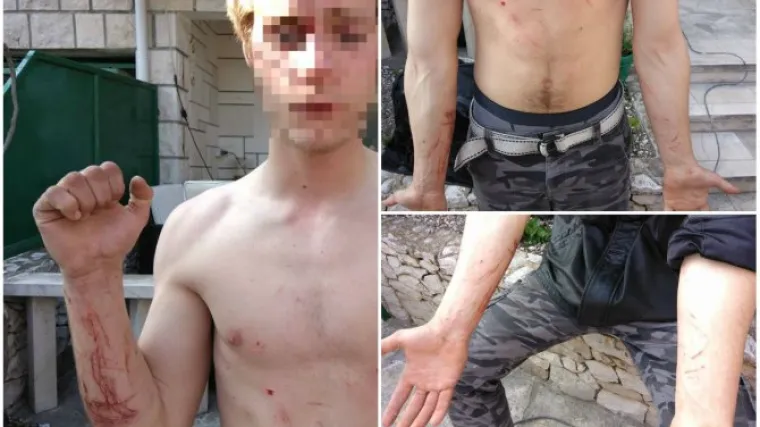 'Teroriziraju cijeli otok, ovo je Afganistan': Bračanin tvrdi da se policija iživljavala nad njegovim sinom