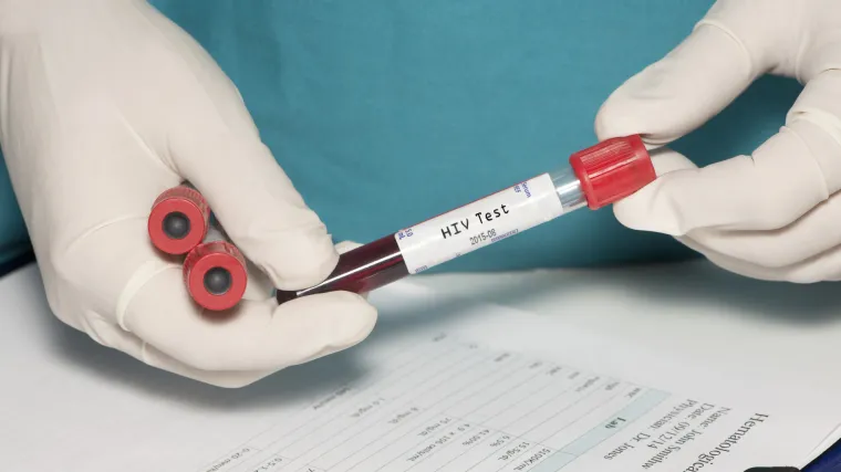 Drugi slučaj u svijetu: 'Londonskom pacijentu' agresivnom terapijom liječili rak pa mu izliječili HIV