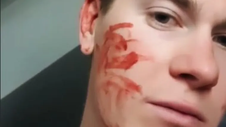Zubčić se sam pokušao ošišati i raskrvario si uho; 'Niš, glup sam...'