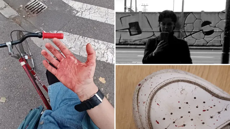 Razgovarali smo s Larom koja je pomogla mladiću kojem je cigla pala na glavu: 'Zvuk udarca je bio tup, užasan...'