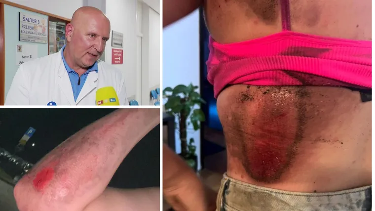 Tinejdžerici koju je vukao autobus ZET-a pomoć pružili u Klaićevoj: 'Bila je šokirana. Ima velike oguljotine...'