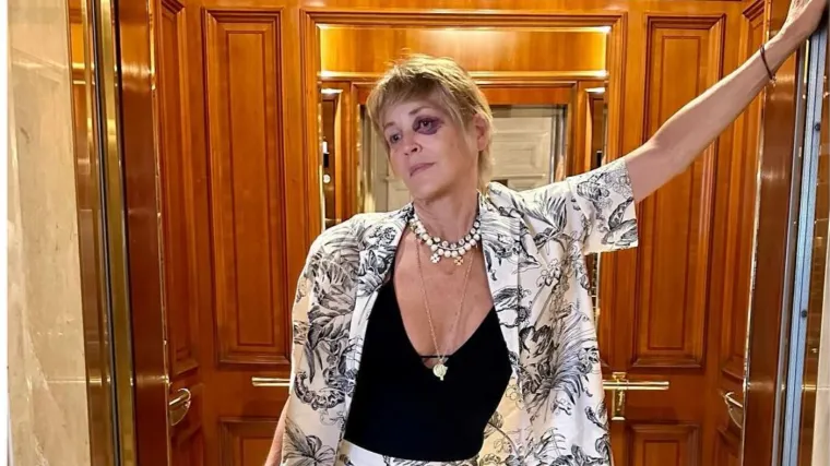Sharon Stone pozirala s masnicom na oku. Obožavatelji zabrinuti: 'Što ti se dogodilo?'