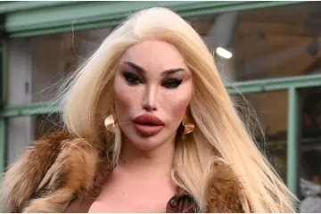 'Ljudska Barbie' ponovno u centru pažnje: Provokativno izdanje kraljice plastičnih operacija