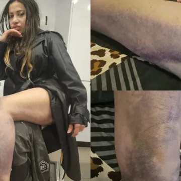 Super Silva o brutalnom napadu bejzbol palicama: 'I dalje mi prijete, bojim se za svoj život'