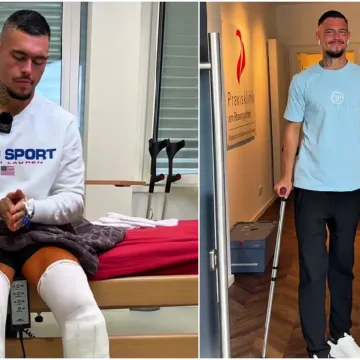 Operacijom produljio noge za 23 cm: 'U agoniji sam, ali vrijedilo je, više nisam nizak'