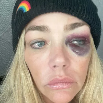 Denise Richards otvoreno o problemima s bivšim suprugom: 'Gušio me, šamarao, udarao...'