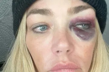 Denise Richards otvoreno o problemima s bivšim suprugom: 'Gušio me, šamarao, udarao...'