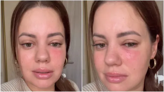 Lucija Lugomer o zdravstvenom problemu: 'Uplašila sam se jer je sve izmaklo kontroli'