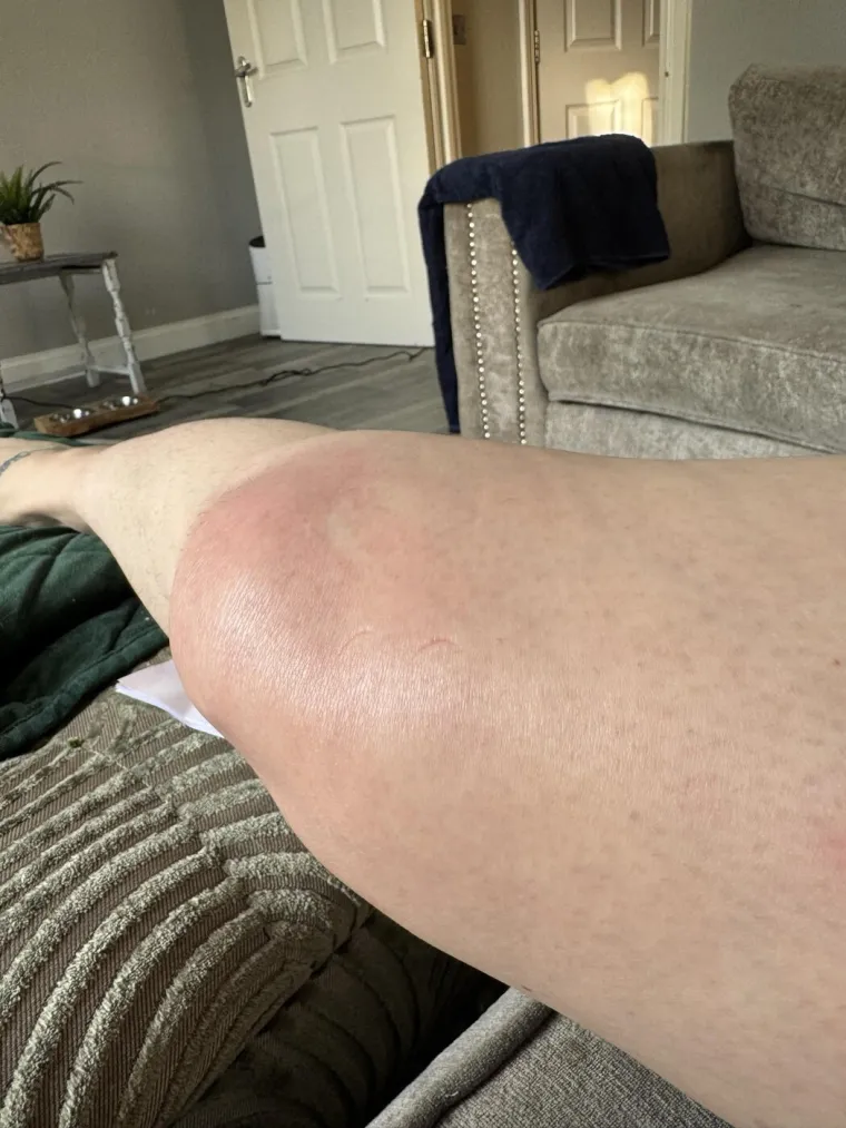 Godinama se žalila na simptome, ali nisu je slu&scaron;ali: 'Mislila sam da se svi bude s bolovima'