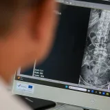 Kronična bol u leđima ne smije biti svakodnevica - upoznajte stručnjake koji pacijentima vraćaju normalan san, kretanje i život