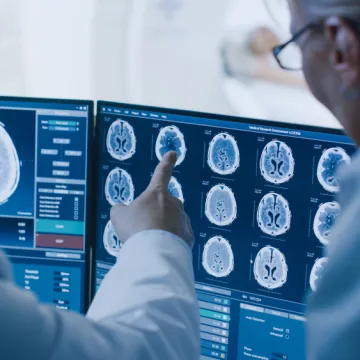 Neurokirurg otkriva pet navika za održavanje mozga zdravim: 'Pobolj&scaron;ava zdravlje'