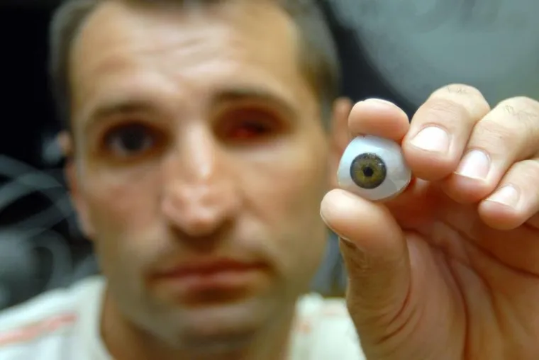 Kristijan Trokter, Oko Kristijan Trokter