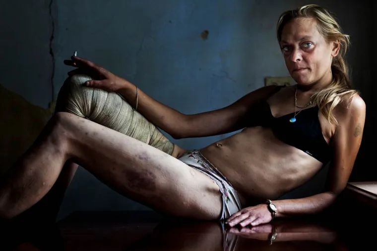Brent Stirton osvojio je prvu nagradu u kategoriji 'Suvremeni problemi - Portret' za fotografiju Marije, prostitutke i ovisnice o drogi.