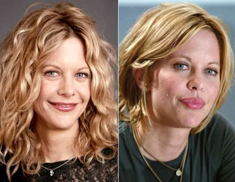 Ljepotice, što ti se dogodilo s licem?