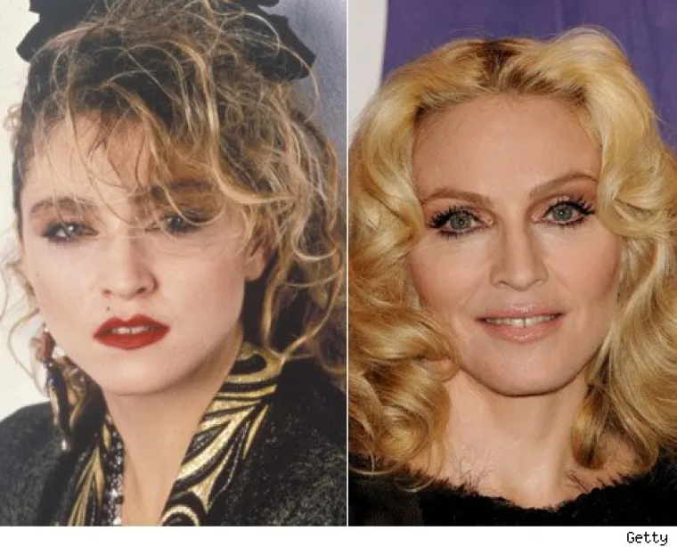 Ljepotice, &scaron;to ti se dogodilo s licem?