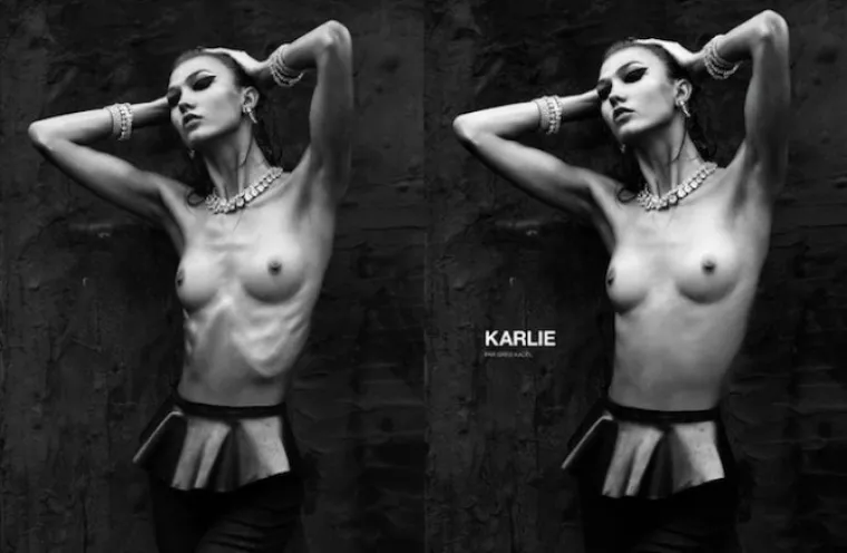 Modni skandal: Photoshopom 'sakrili' manekenki rebra!