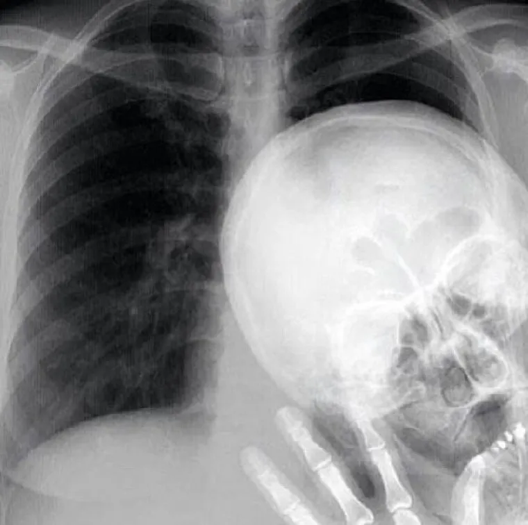 NAMJERNO I SLUČAJNO: 'U**ali' im cijelu stvar, a toliko su se trudili napraviti savr&scaron;enstvo