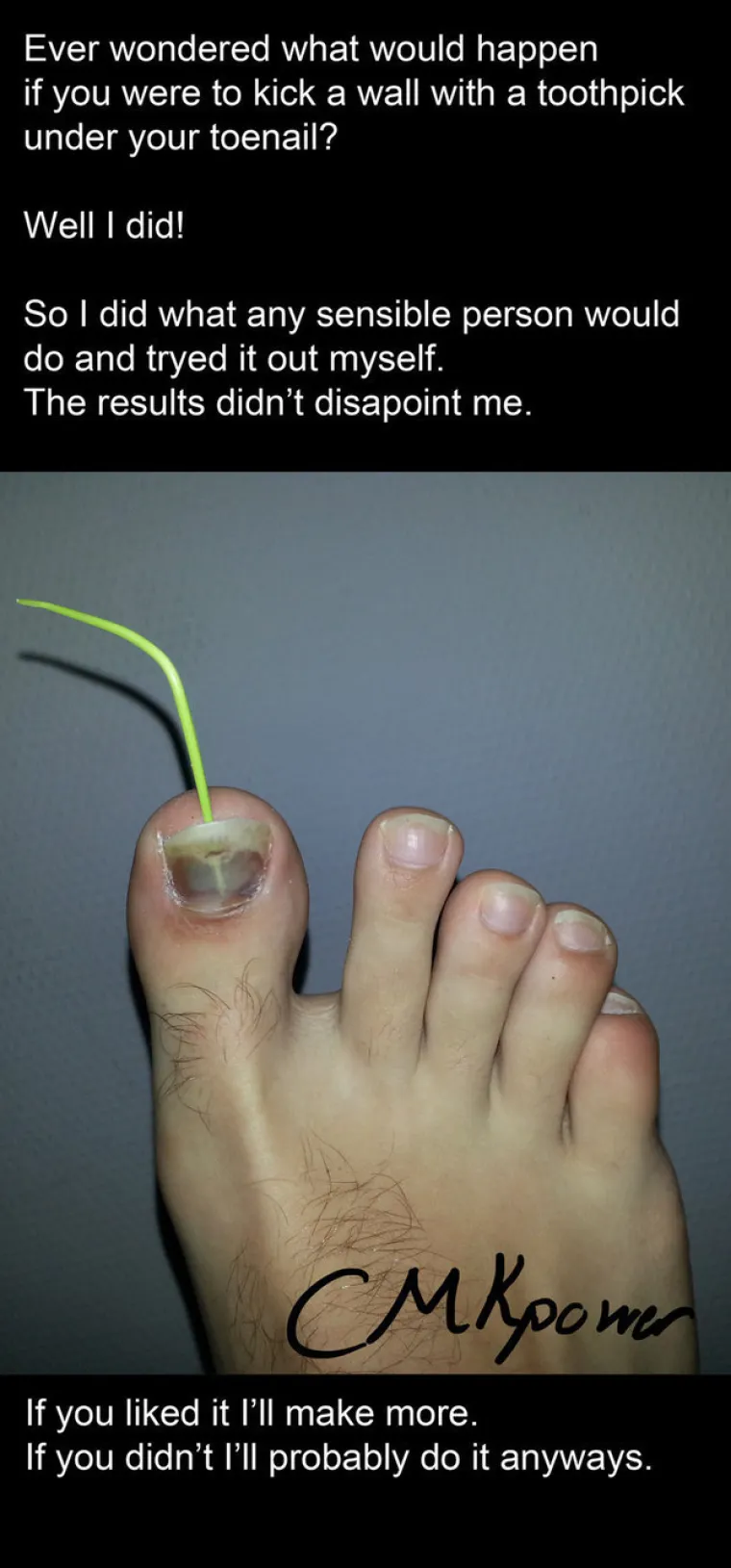 Gadljivost je vrlo subjektivna, ali ako uspijete pogledati galeriju do kraja i ostati pri svijesti, vjerojatno niste nimalo gadljivi. Upozorili smo vas, a na vama je da testirate svoju gadljivost ako mislite da ste dovoljno otporni.