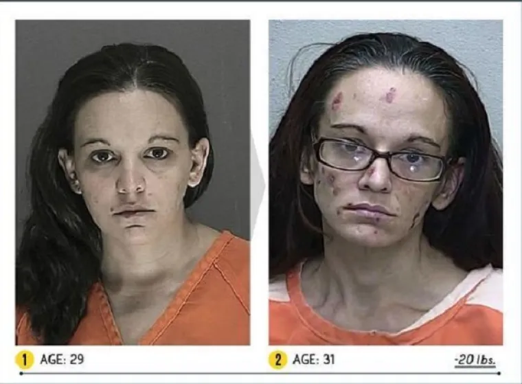 LICA OVISNOSTI: Brutalna istina o propadanju ovisnika o teškim drogama