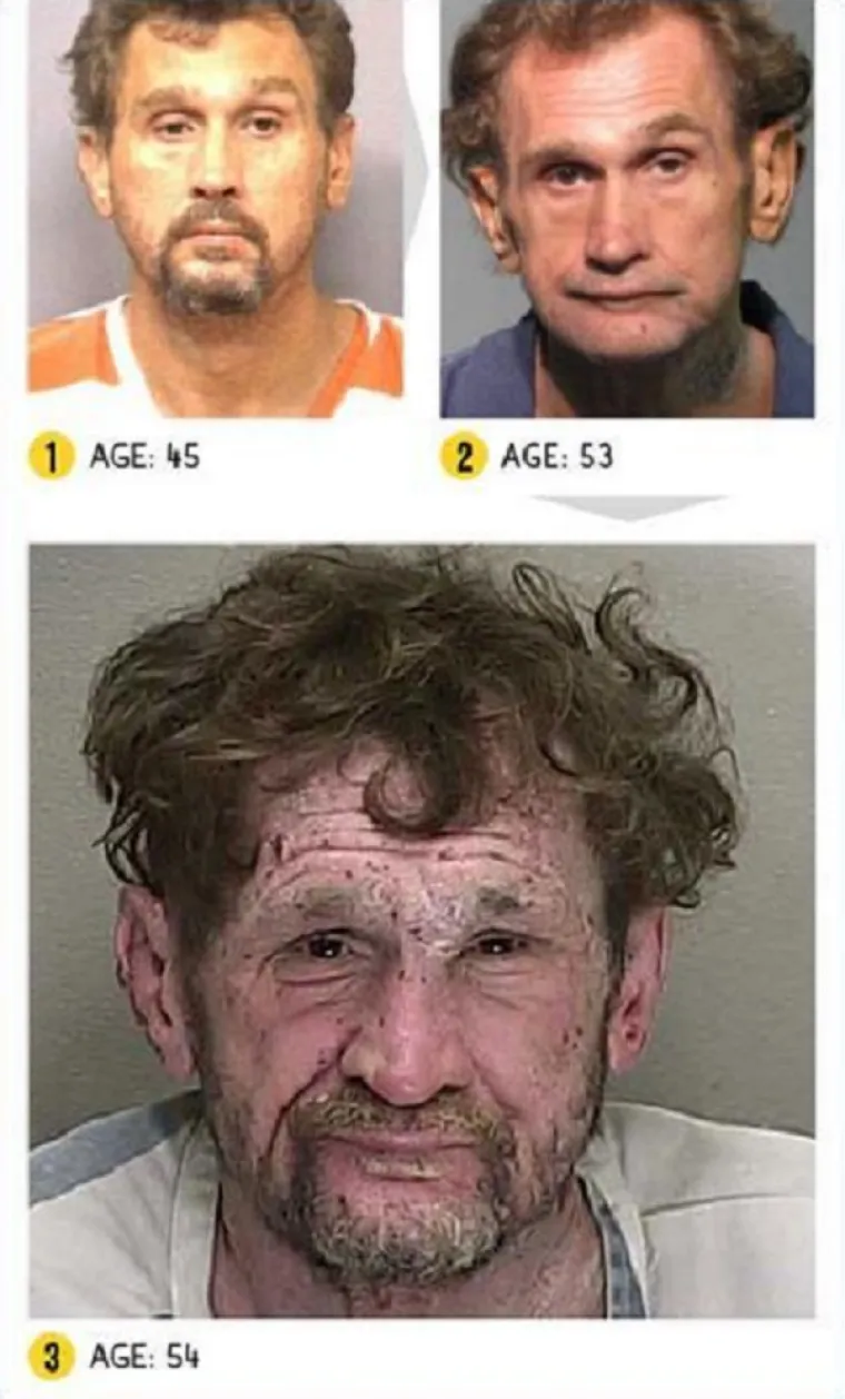 LICA OVISNOSTI: Brutalna istina o propadanju ovisnika o teškim drogama