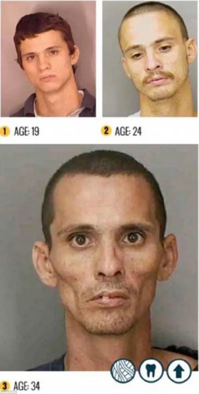 LICA OVISNOSTI: Brutalna istina o propadanju ovisnika o teškim drogama