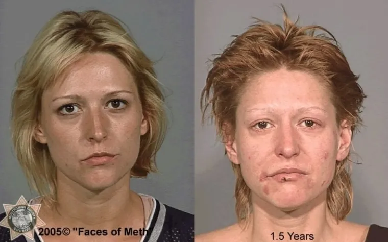 LICA OVISNOSTI: Brutalna istina o propadanju ovisnika o teškim drogama