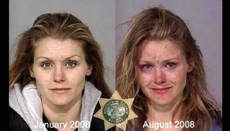 LICA OVISNOSTI: Brutalna istina o propadanju ovisnika o teškim drogama