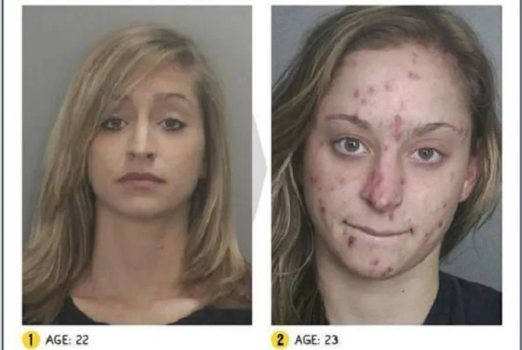 LICA OVISNOSTI: Brutalna istina o propadanju ovisnika o teškim drogama