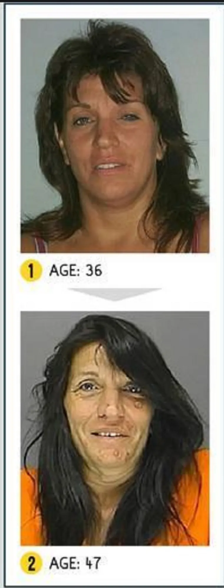 LICA OVISNOSTI: Brutalna istina o propadanju ovisnika o teškim drogama