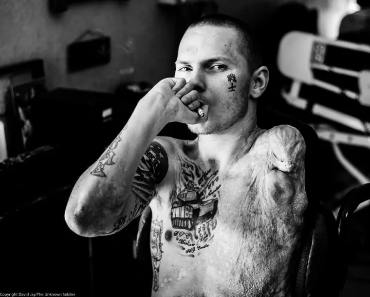 Te&scaron;ko ranjeni vojnici