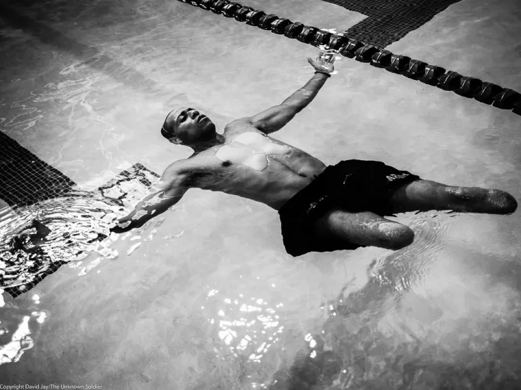 Te&scaron;ko ranjeni vojnici