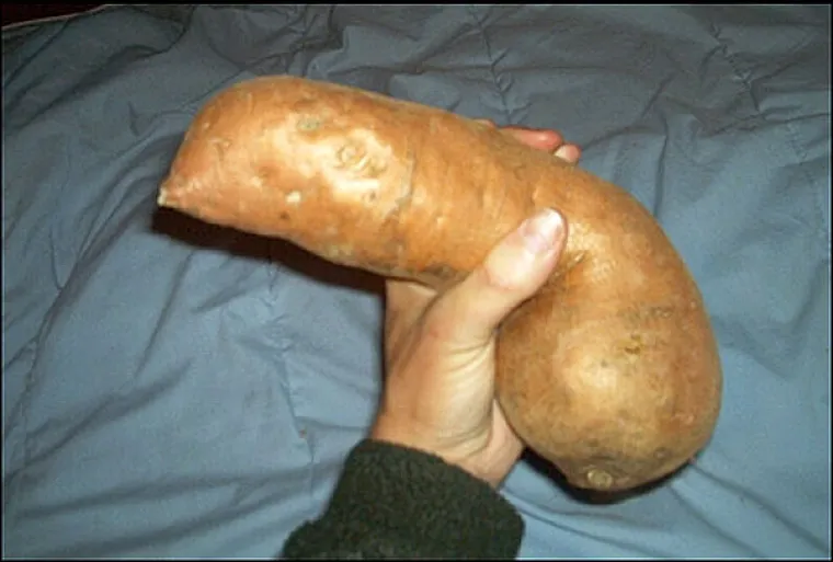 Na &scaron;to vas podsjećaju ovi sasvim nevini prizori?