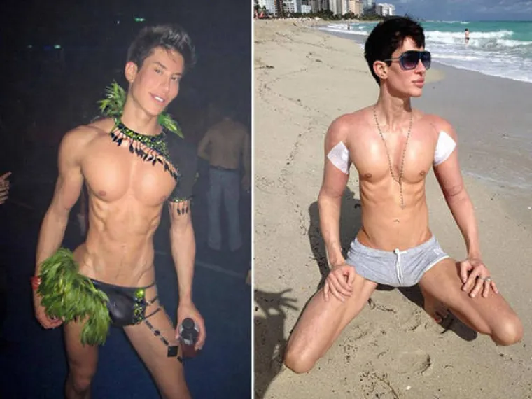 Nakon &scaron;to pogledate posljedice njihovih operacija, naučit ćete cijeniti svoju grbu na nosu