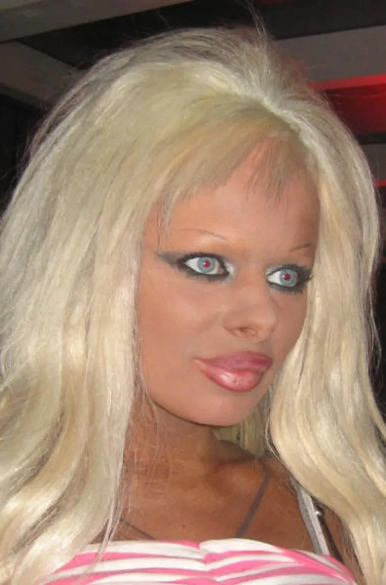 Nakon &scaron;to pogledate posljedice njihovih operacija, naučit ćete cijeniti svoju grbu na nosu