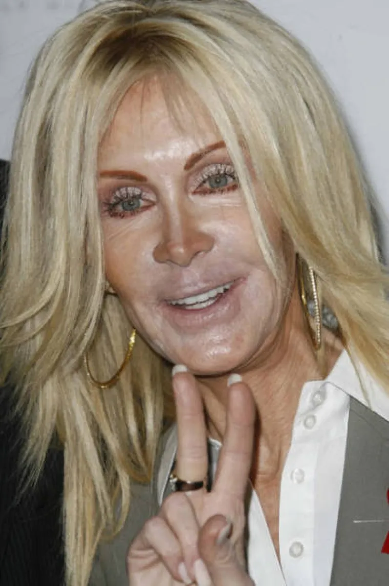 Nakon &scaron;to pogledate posljedice njihovih operacija, naučit ćete cijeniti svoju grbu na nosu