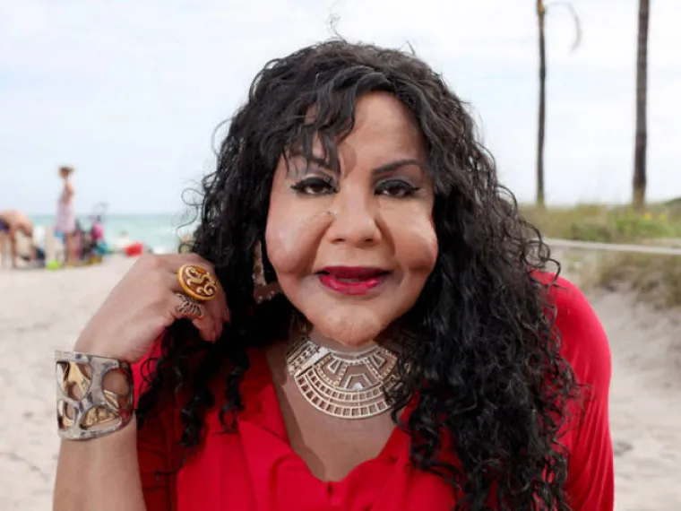 Nakon &scaron;to pogledate posljedice njihovih operacija, naučit ćete cijeniti svoju grbu na nosu