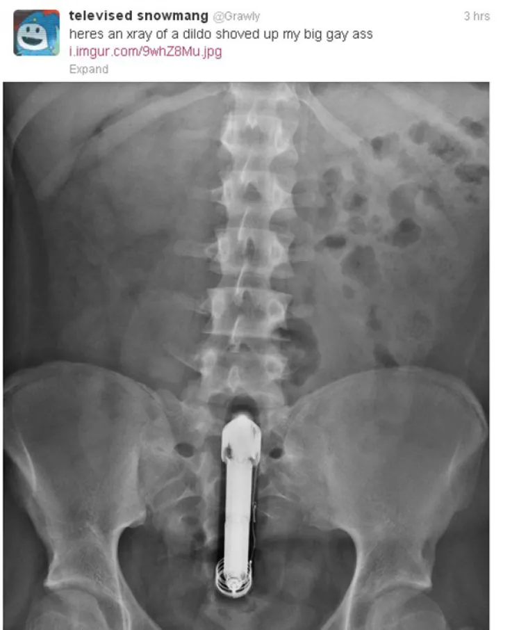 A za kraj je podijelio i rengensku fotku vibratora.