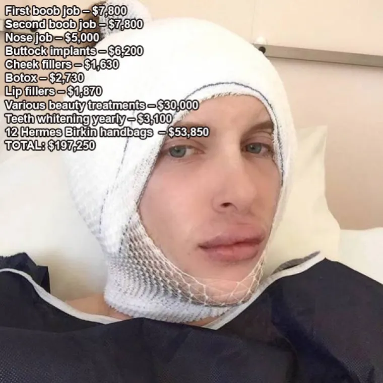 BOLESNO LIJEPI? Spiskali su preko milijun i pol kuna da bi izgledali... ovako