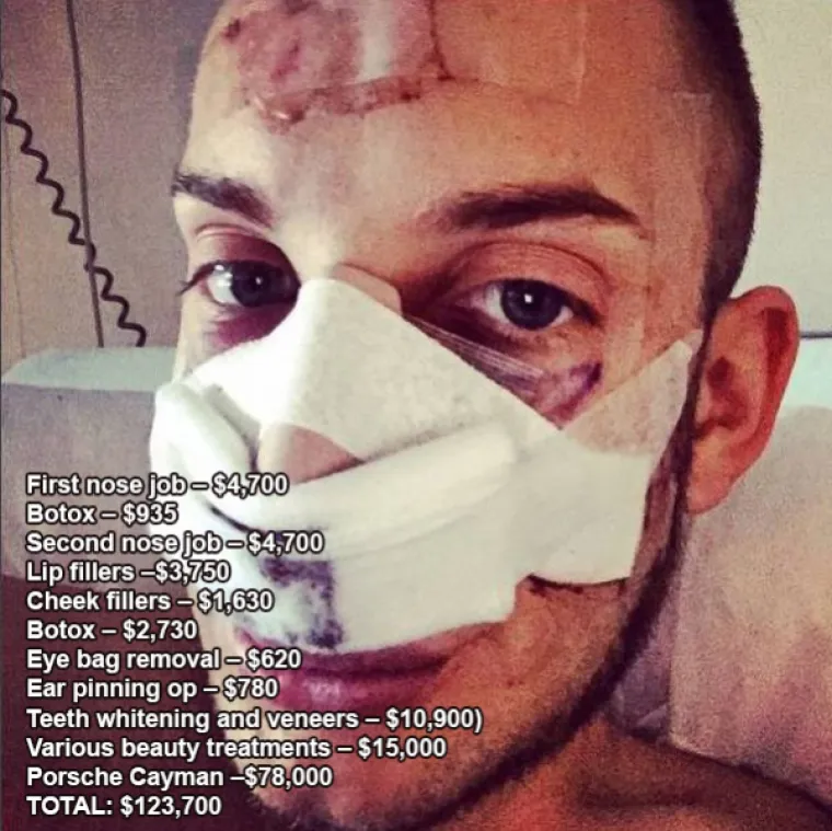 BOLESNO LIJEPI? Spiskali su preko milijun i pol kuna da bi izgledali... ovako