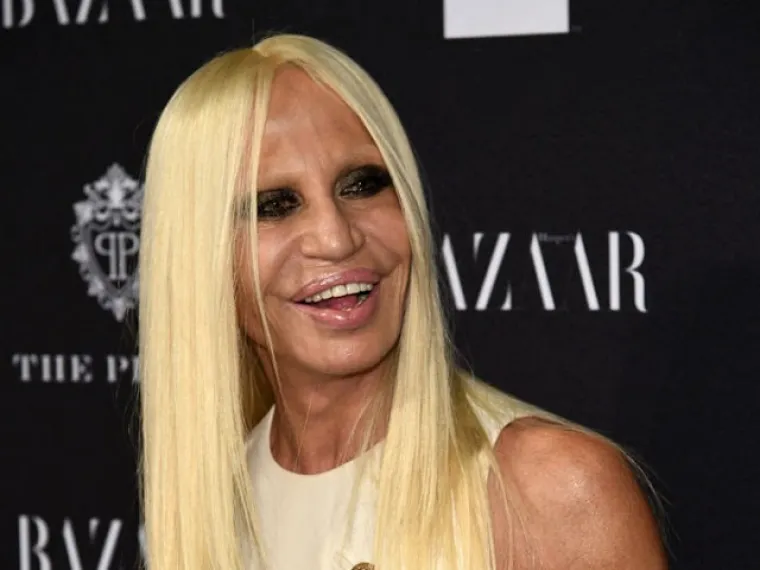 Kad se poznati unakaze plastičnim operacijama, rezultati mogu biti zastra&scaron;ujući