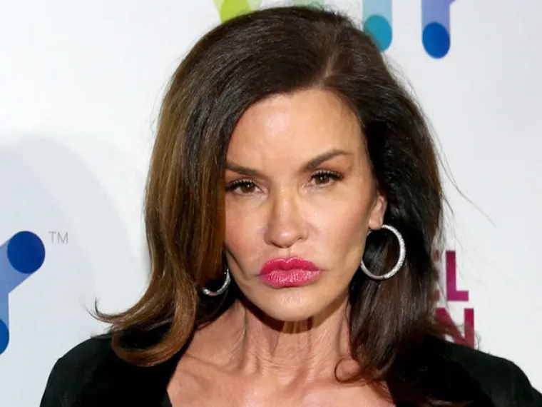 Kad se poznati unakaze plastičnim operacijama, rezultati mogu biti zastra&scaron;ujući