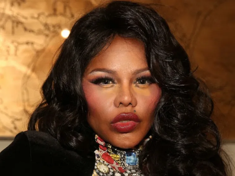 Kad se poznati unakaze plastičnim operacijama, rezultati mogu biti zastra&scaron;ujući