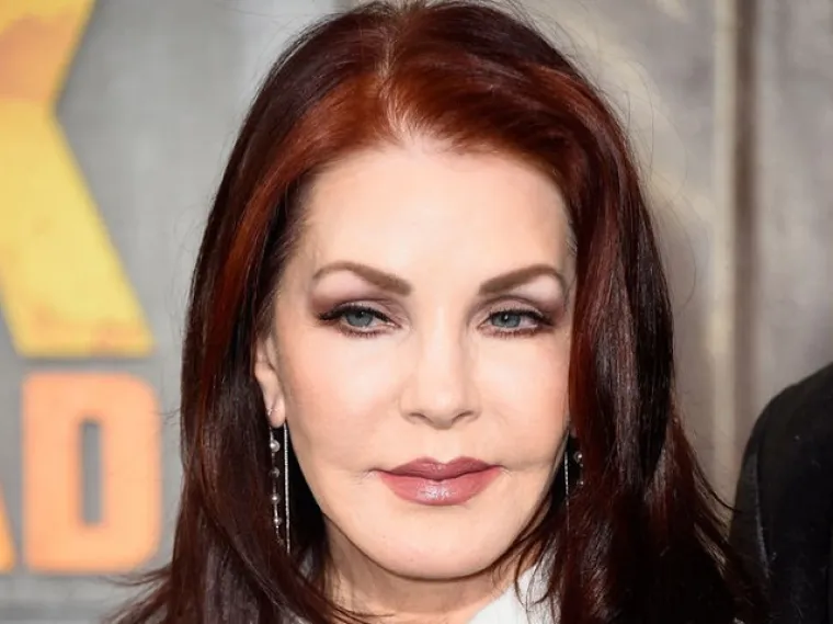 Kad se poznati unakaze plastičnim operacijama, rezultati mogu biti zastra&scaron;ujući