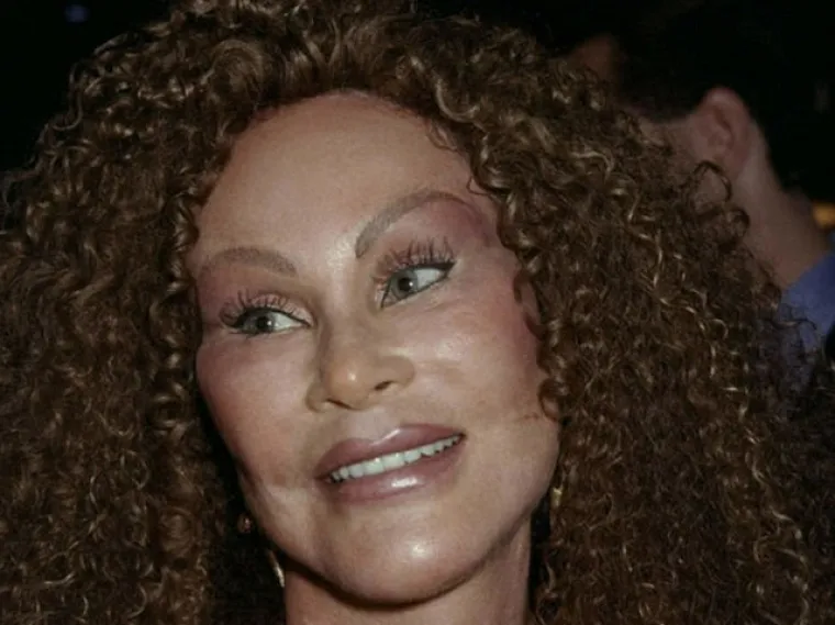 Jocelyn Wildenstein