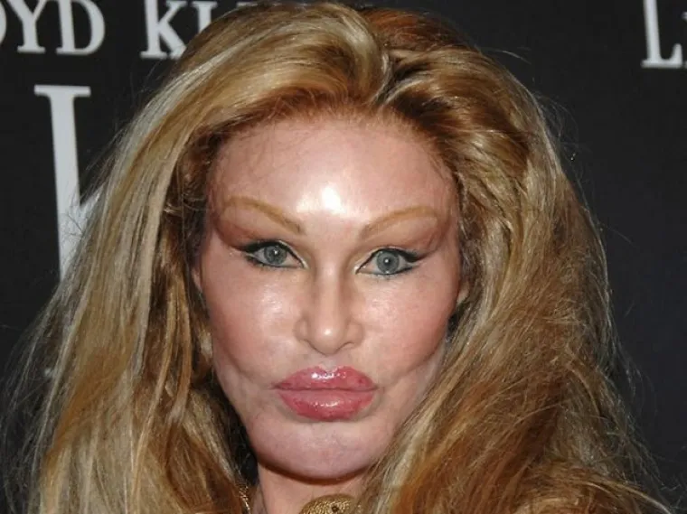 Kad se poznati unakaze plastičnim operacijama, rezultati mogu biti zastra&scaron;ujući